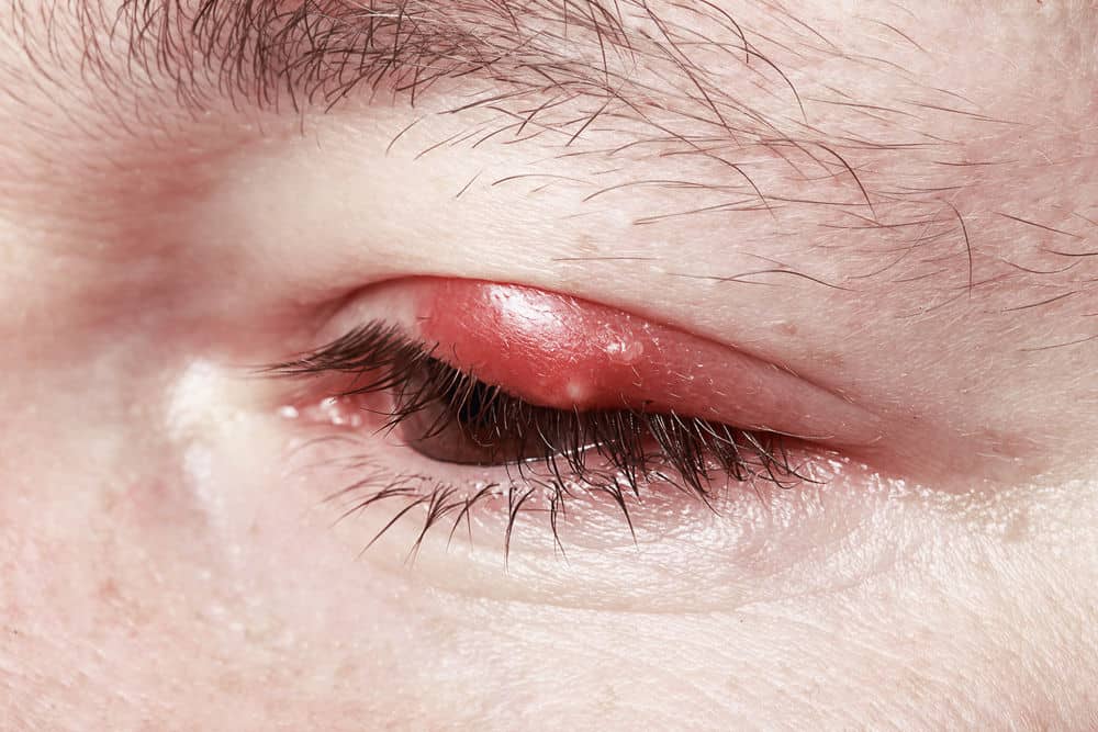 eye problems 6 eye symptoms you should not ignore eye problems 6 eye symptoms you should not ignore