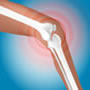 Joint & Bone Health