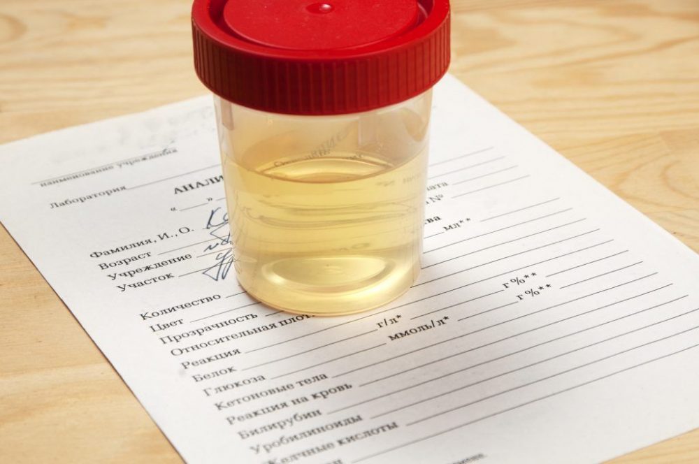 Decoding Your Urine's Color