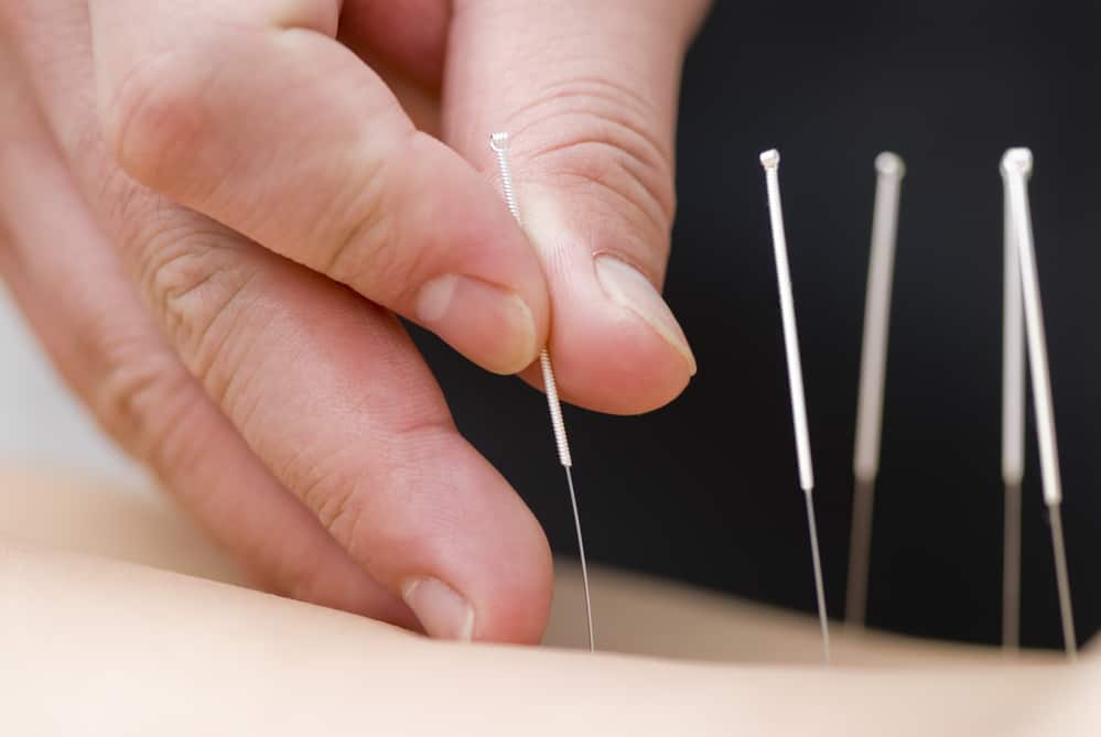 Acupuncture can help relieve pain from arthritis.