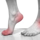 Redness on feet