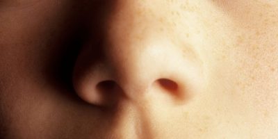 Does Everyone Have A Philtrum and Why Do We Have It?
