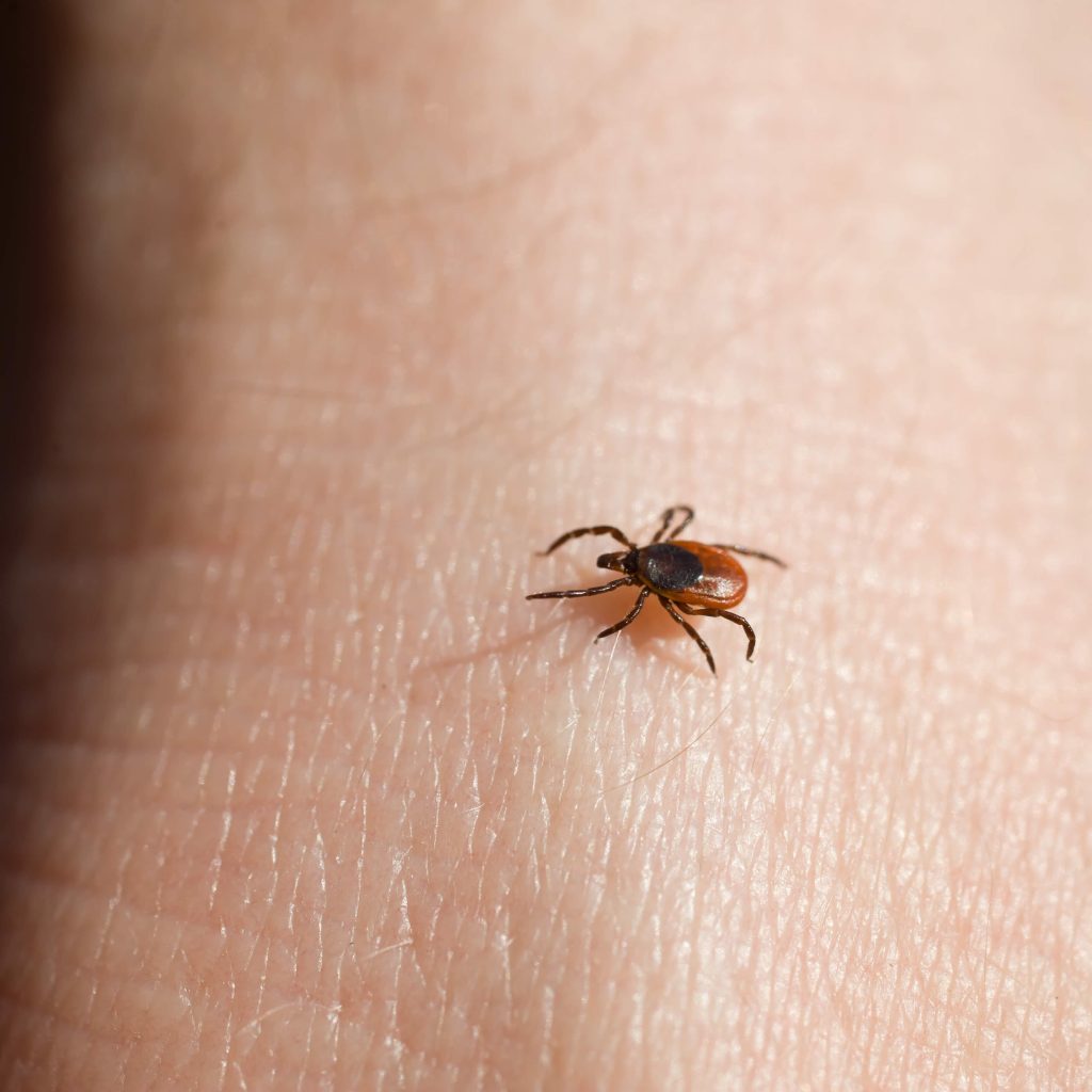 How to Recognize & Prevent Lyme Disease in Tick Season 2018