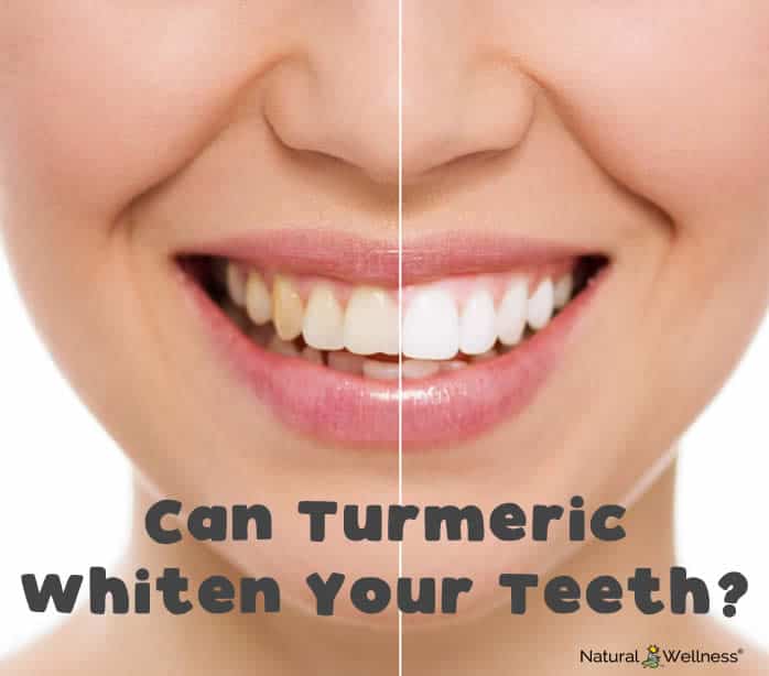 Can Turmeric Whiten Your Teeth