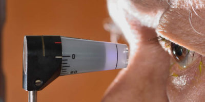 Glaucoma: Symptoms, Risk Factors & Prevention