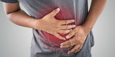 Irritable Bowel Syndrome (IBS): Symptoms, Causes, Diagnosis, and Treatment