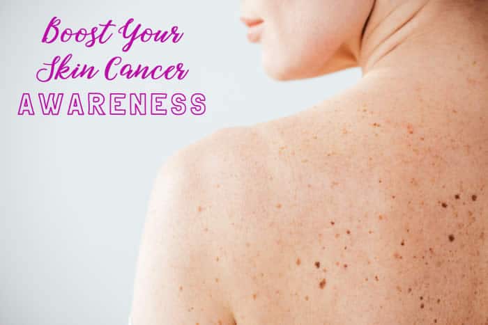 Boost Your Skin Cancer Awareness